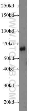 ODF2L Antibody in Western Blot (WB)