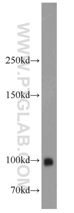 MME/CD10 Antibody in Western Blot (WB)