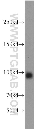 MME/CD10 Antibody in Western Blot (WB)