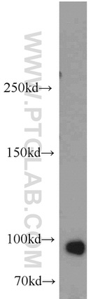 MME/CD10 Antibody in Western Blot (WB)