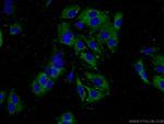 MYO19 Antibody in Immunocytochemistry (ICC/IF)