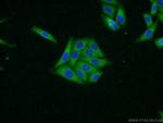 SOLO Antibody in Immunocytochemistry (ICC/IF)