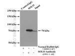 SOLO Antibody in Immunoprecipitation (IP)