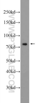 SOLO Antibody in Western Blot (WB)