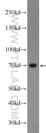 SOLO Antibody in Western Blot (WB)