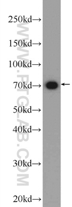 SOLO Antibody in Western Blot (WB)