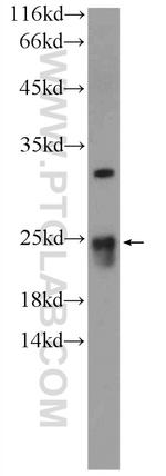 FAM158A Antibody in Western Blot (WB)