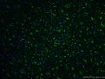 GFAP Antibody in Immunohistochemistry (PFA fixed) (IHC (PFA))