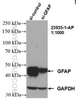 GFAP Antibody in Western Blot (WB)