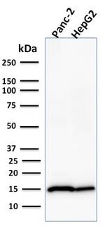 Frataxin Antibody in Western Blot (WB)