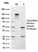 Frataxin (Mitochondrial Marker) Antibody in SDS-PAGE (SDS-PAGE)