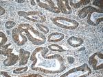 CHPF N-terminal Antibody in Immunohistochemistry (Paraffin) (IHC (P))