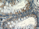 CHPF N-terminal Antibody in Immunohistochemistry (Paraffin) (IHC (P))