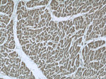 CHPF N-terminal Antibody in Immunohistochemistry (Paraffin) (IHC (P))