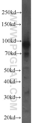 CHPF N-terminal Antibody in Western Blot (WB)