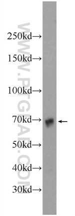 CHPF N-terminal Antibody in Western Blot (WB)