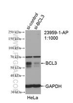 BCL3 Antibody in Western Blot (WB)