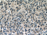 BCL3 Antibody in Immunohistochemistry (Paraffin) (IHC (P))