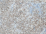 BCL3 Antibody in Immunohistochemistry (Paraffin) (IHC (P))