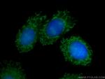BCL3 Antibody in Immunocytochemistry (ICC/IF)