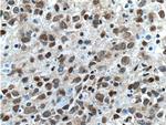 BCL3 Antibody in Immunohistochemistry (Paraffin) (IHC (P))