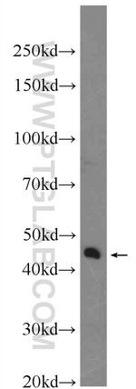 XKR6 Antibody in Western Blot (WB)