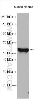 Angiotensinogen Antibody in Western Blot (WB)