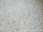 EB3 Antibody in Immunohistochemistry (Paraffin) (IHC (P))