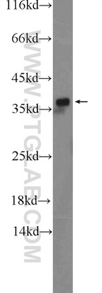 EB3 Antibody in Western Blot (WB)