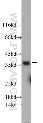 EB3 Antibody in Western Blot (WB)