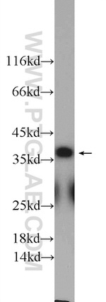 EB3 Antibody in Western Blot (WB)