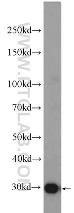 EB3 Antibody in Western Blot (WB)