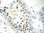 BARHL2 Antibody in Immunohistochemistry (Paraffin) (IHC (P))