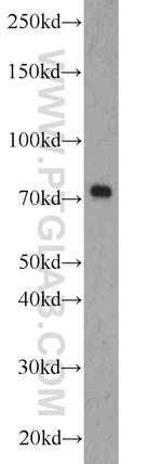 ZBTB20 Antibody in Western Blot (WB)