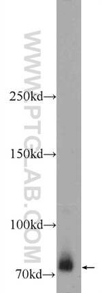 ZBTB20 Antibody in Western Blot (WB)