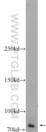 ZBTB20 Antibody in Western Blot (WB)