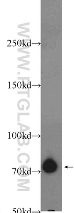 ZBTB20 Antibody in Western Blot (WB)