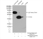 TMEM55B Antibody in Immunoprecipitation (IP)