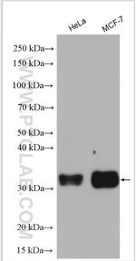 TMEM55B Antibody in Western Blot (WB)