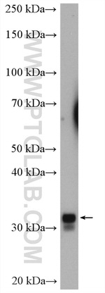 TMEM55B Antibody in Western Blot (WB)