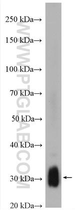 TMEM55B Antibody in Western Blot (WB)