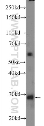 TMEM55B Antibody in Western Blot (WB)