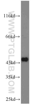 ATPBD4 Antibody in Western Blot (WB)