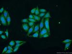 TFAM Antibody in Immunocytochemistry (ICC/IF)