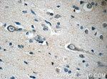 TFAM Antibody in Immunohistochemistry (Paraffin) (IHC (P))