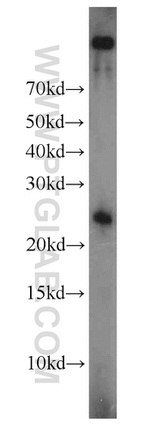 TFAM Antibody in Western Blot (WB)