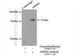 AMPD3 Antibody in Immunoprecipitation (IP)