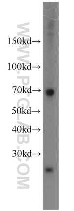 AMPD3 Antibody in Western Blot (WB)