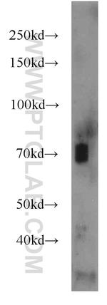 AMPD3 Antibody in Western Blot (WB)