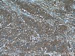 B4GALNT2 Antibody in Immunohistochemistry (Paraffin) (IHC (P))